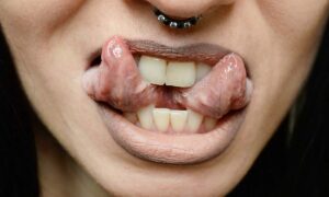 سلامت دهان و پیرسینگ زبان