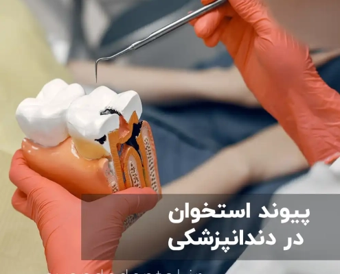 پیوند استخوان در دندانپزشکی