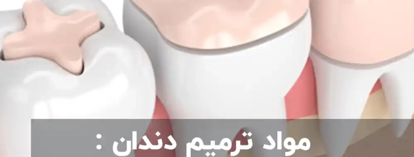 مواد ترمیم دندان : انواع مختلف