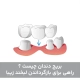 بریج دندان چیست ؟ راهی برای بازگرداندن لبخند زیبا