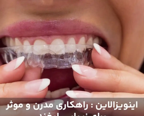 اینویزالاین : راهکاری مدرن و موثر برای زیبایی لبخند