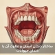 ساختار دندان‌ انسان و تفاوت آن با دندان حیوانات