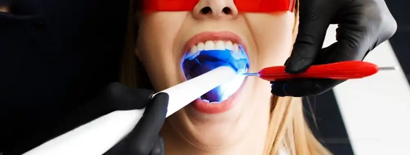 لکه ‌گیری دندان چیست