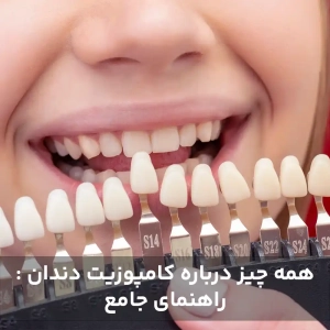همه چیز درباره کامپوزیت دندان : راهنمای جامع