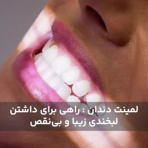 لمینت دندان : راهی برای داشتن لبخندی زیبا و بی‌نقص