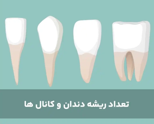 تعداد ریشه دندان و کانال ها
