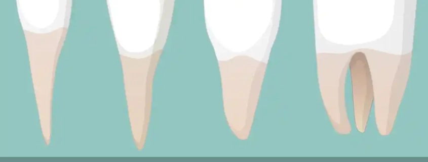 تعداد ریشه دندان و کانال ها