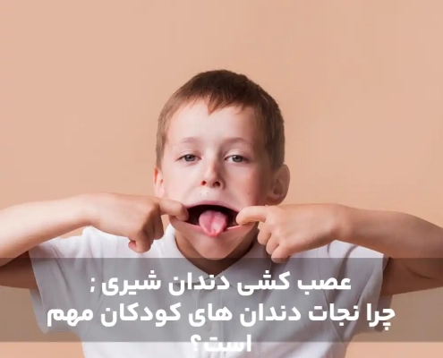 عصب کشی دندان شیری ; چرا نجات دندان ‌های کودکان مهم است؟