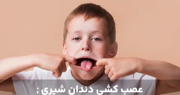 عصب کشی دندان شیری ; چرا نجات دندان ‌های کودکان مهم است؟