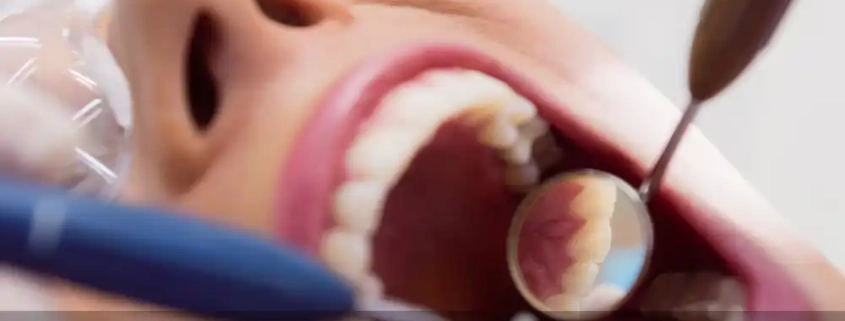 درمان ریشه دندان : نجات دندان‌های آسیب‌دیده