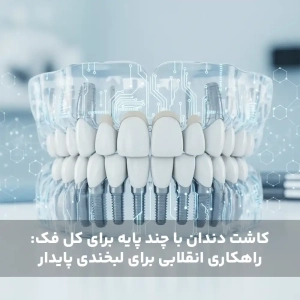 کاشت دندان با چند پایه برای کل فک: راهکاری انقلابی برای لبخندی پایدار
