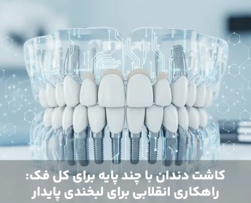 کاشت دندان با چند پایه برای کل فک: راهکاری انقلابی برای لبخندی پایدار