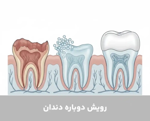 رویش دوباره دندان
