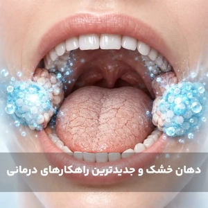 دهان خشک و جدیدترین راهکارهای درمانی