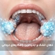 دهان خشک و جدیدترین راهکارهای درمانی