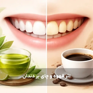 اثر قهوه و چای بر دندان