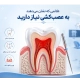 علائم نیاز به عصب کشی دندان چیست؟ | راهنمای کامل درمان ریشه در غرب تهران