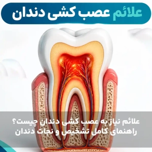 علائم نیاز به عصب کشی دندان چیست؟ راهنمای کامل تشخیص و نجات دندان