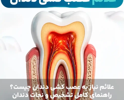 علائم نیاز به عصب کشی دندان چیست؟ راهنمای کامل تشخیص و نجات دندان