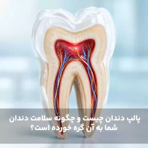 پالپ دندان چیست و چگونه سلامت دندان شما به آن گره خورده است؟