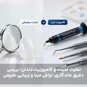تفاوت لمینت و کامپوزیت دندان؛ بررسی دقیق ماندگاری، تراش مینا و زیبایی طبیعی