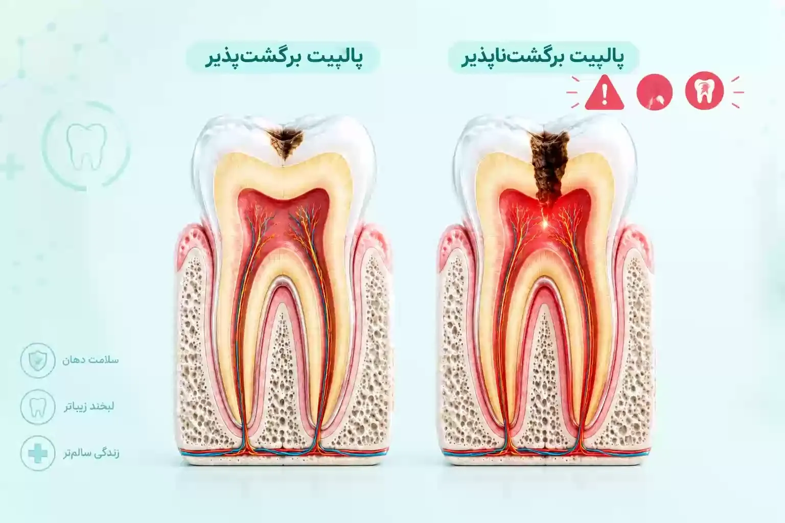  تفاوت بالینی پالپیت برگشت‌پذیر و برگشت‌ناپذیر در دندان انسان همراه با علائم بالینی